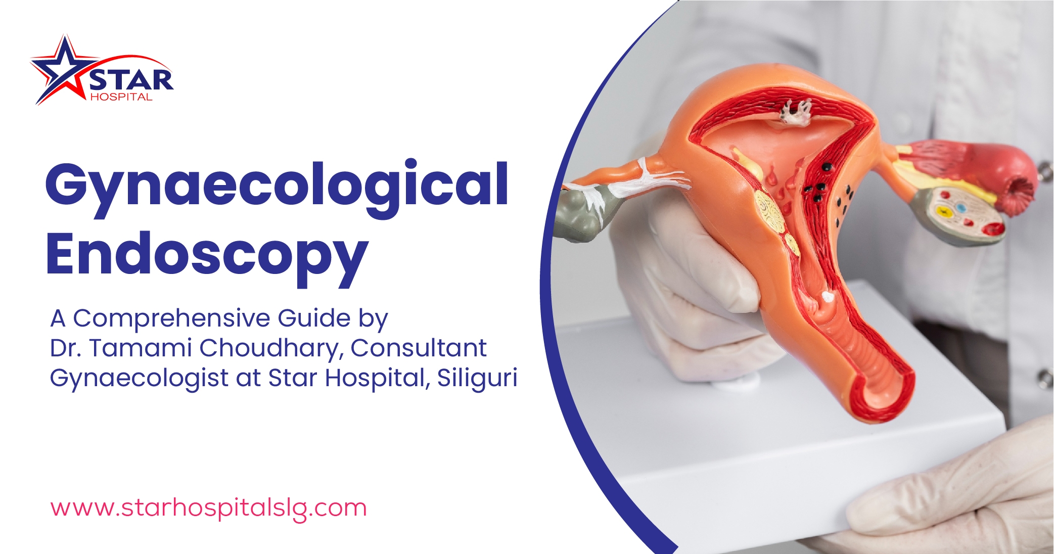 Gynaecological Endoscopy:  A Comprehensive Guide by Dr. Tamami Choudhary, Consultant Gynaecologist at Star Hospital, Siliguri