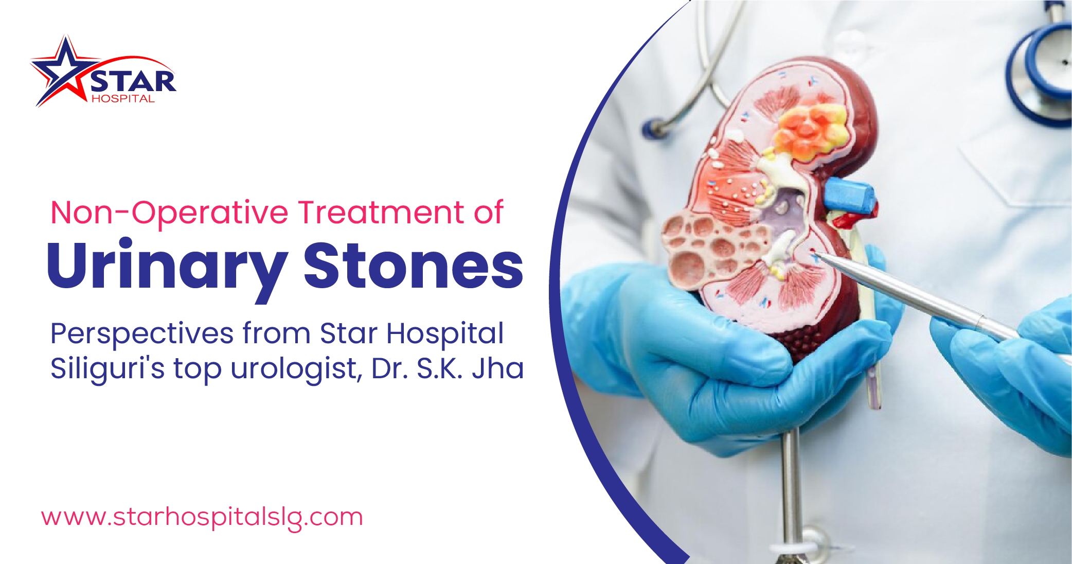 Non-Operative Treatment of Urinary Stones: Perspectives from Star Hospital Siliguri's top urologist, Dr. S.K. Jha